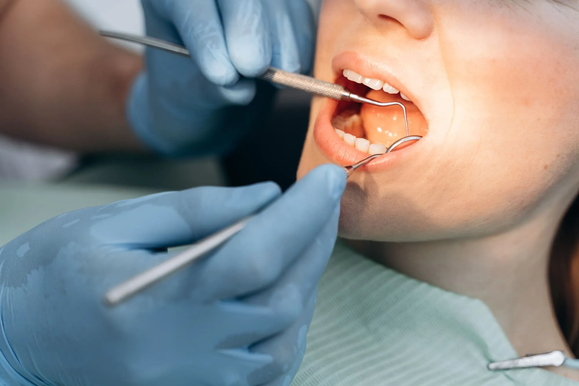 endodoncia en Torrelodones