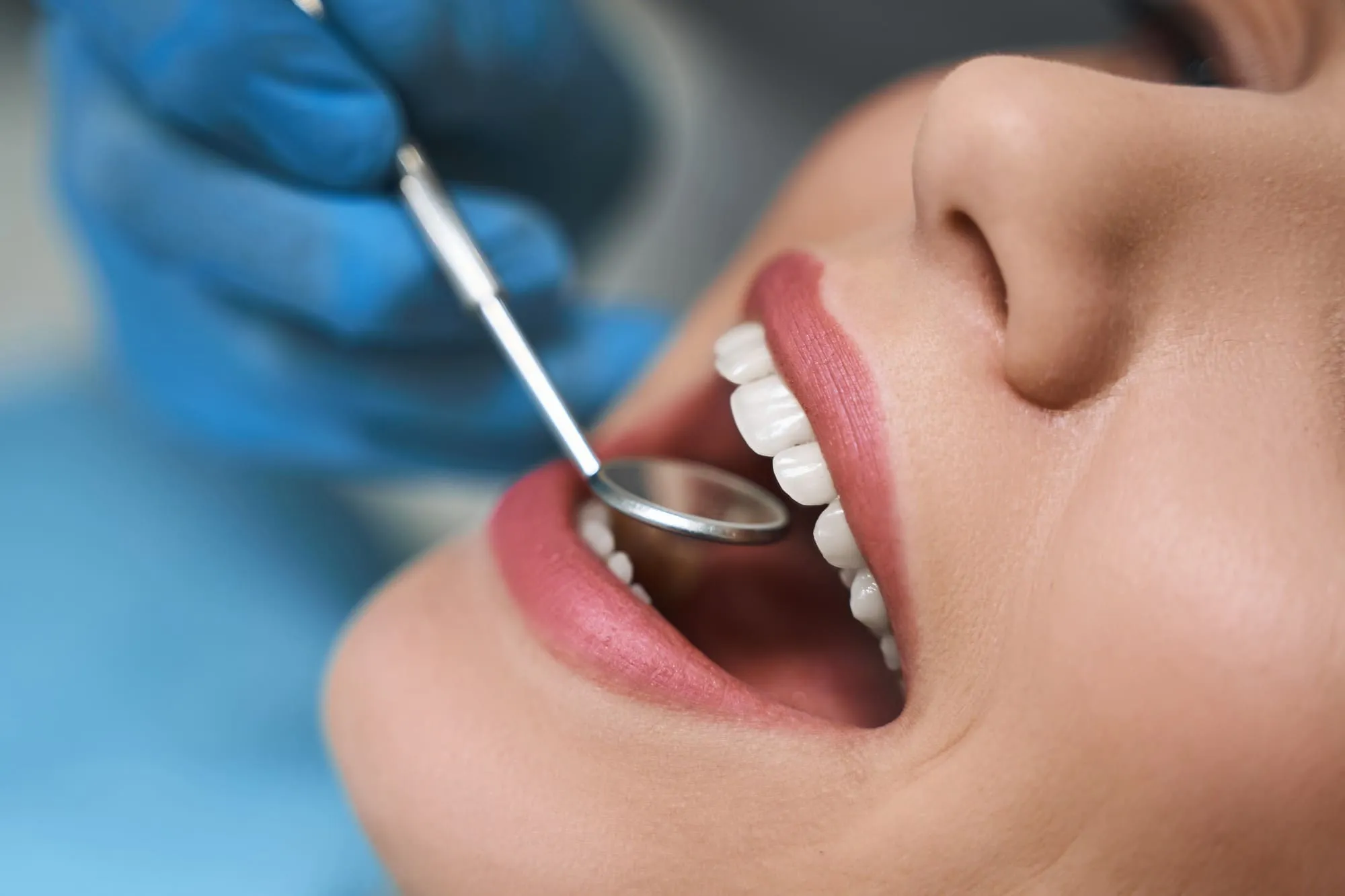 endodoncia en Torrelodones